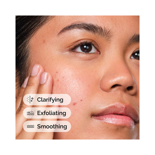 The Ordinary Salicylic Acid 2% Solution 30ml