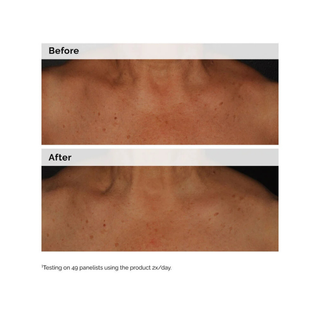 The Ordinary Niacinamide 5% Face and Body Emulsion 100ml