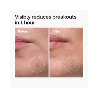 The Ordinary Sulfur 10% Powder-to-Cream Concentrate 5g