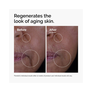 The Ordinary GF 15% Solution 30ml