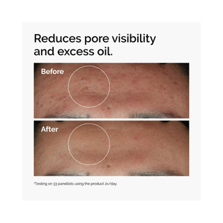 The Ordinary Niacinamide 10% + Zinc 1%