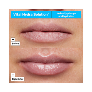 Vital Hydra Solution™ Lip Mask