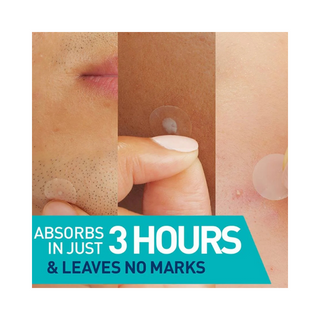 CeraVe Blemish Barrier Patches 22pcs